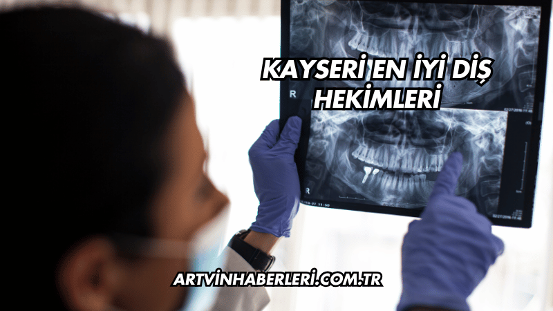 Kayseri En İyi Diş Hekimleri