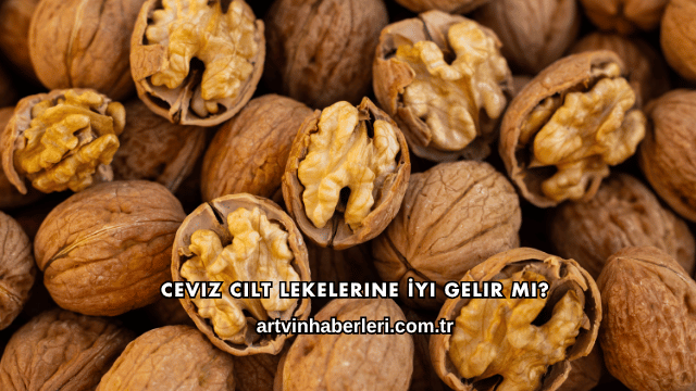 Ceviz Cilt Lekelerine İyi Gelir mi?