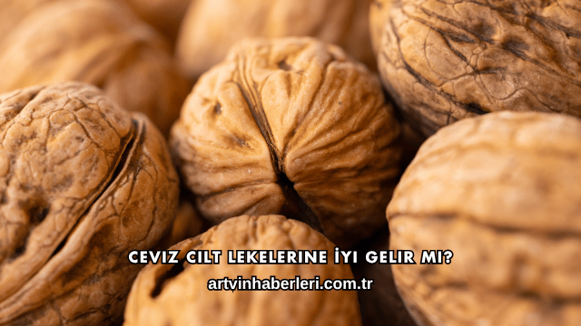 Ceviz Cilt Lekelerine İyi Gelir mi?