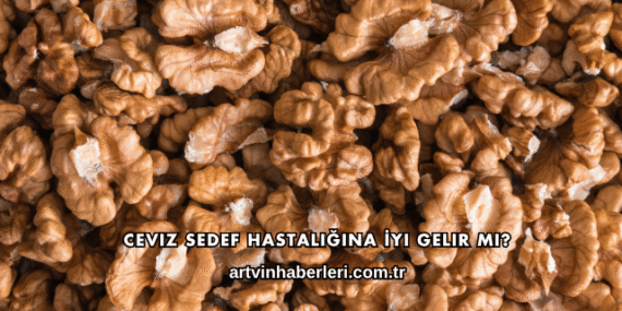 Ceviz Sedef Hastalığına İyi Gelir mi?