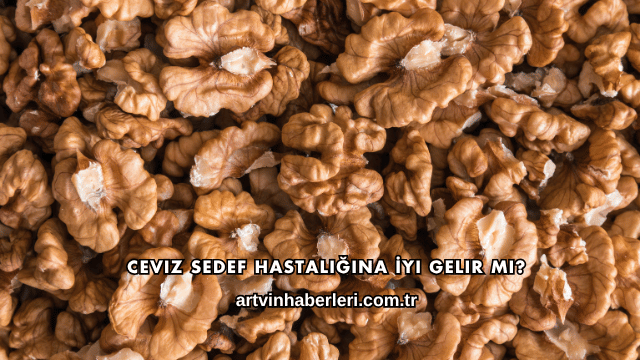 Ceviz Sedef Hastalığına İyi Gelir mi?