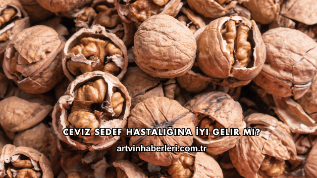 Ceviz Sedef Hastalığına İyi Gelir mi?