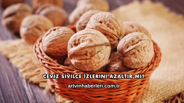 Ceviz Sivilce İzlerini Azaltır mı?